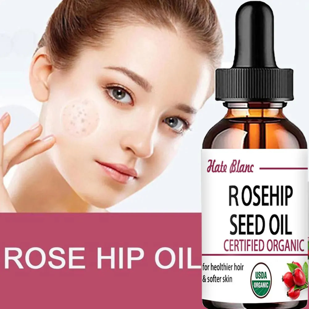 Rosehip Essential Oil – Moisturizing & Brightening