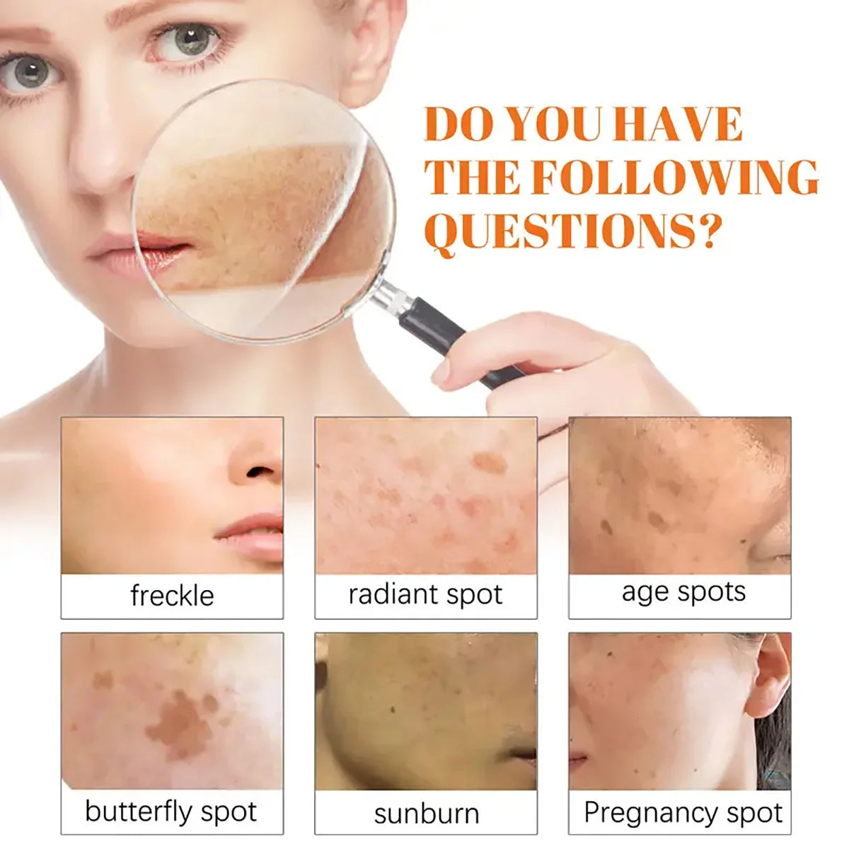 Rosehip Essential Oil – Moisturizing & Brightening