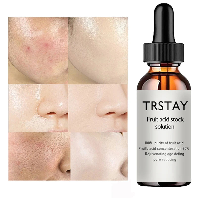 Glycolic Acid Facial Essence – Anti-Aging & Repair