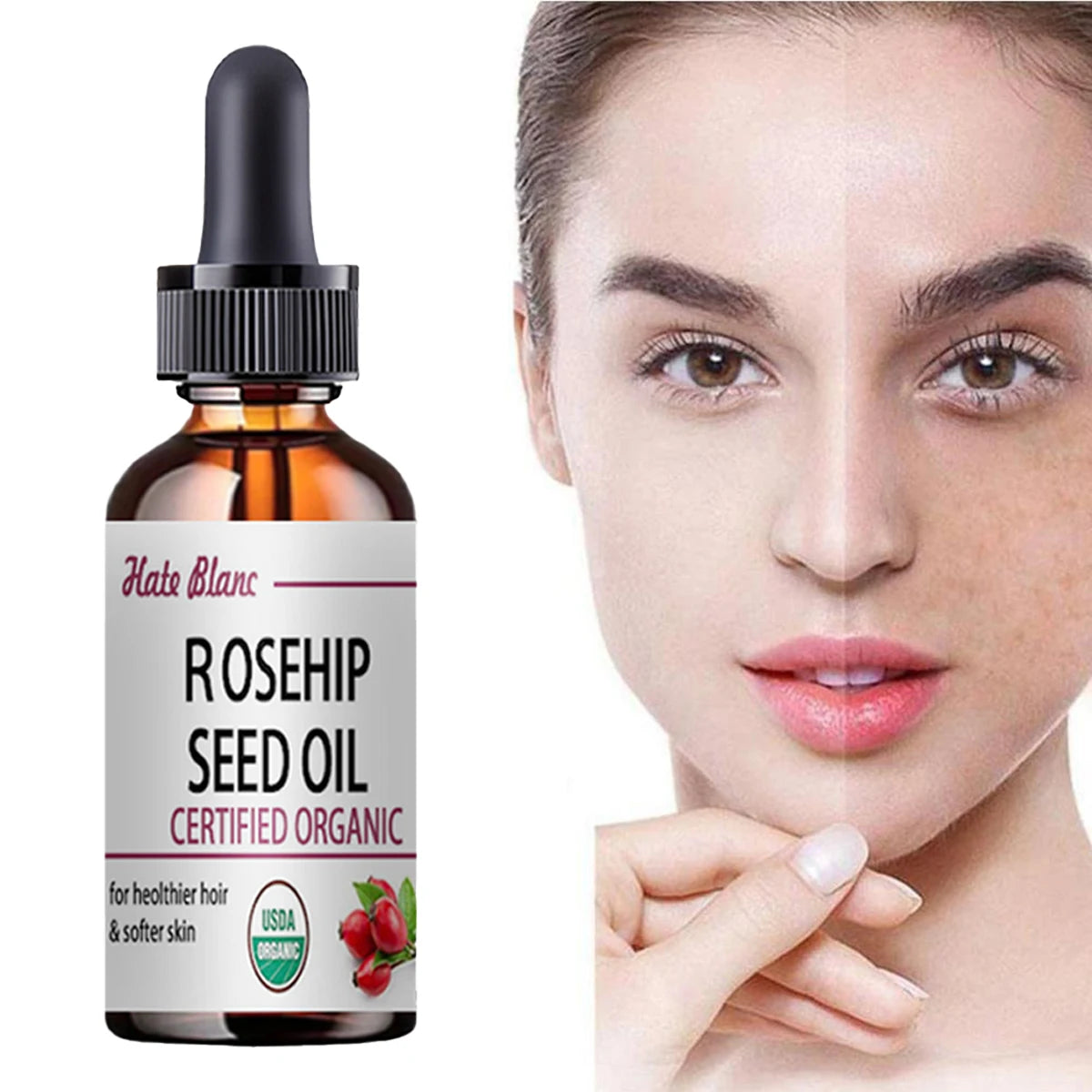 Rosehip Essential Oil – Moisturizing & Brightening