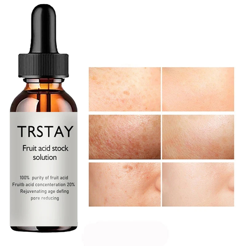 Glycolic Acid Facial Essence – Anti-Aging & Repair