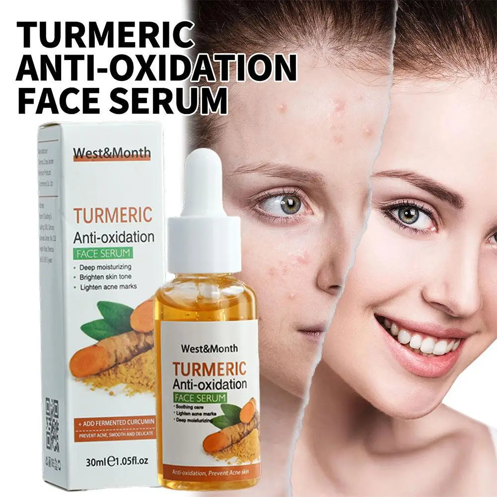 Turmeric Face Serum – Brightening & Dark Spot Corrector