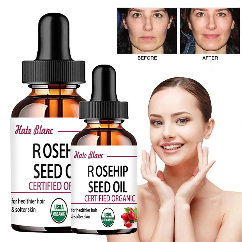 Rosehip Essential Oil – Moisturizing & Brightening