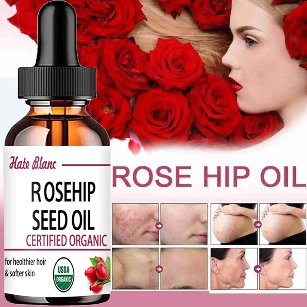 Rosehip Essential Oil – Moisturizing & Brightening