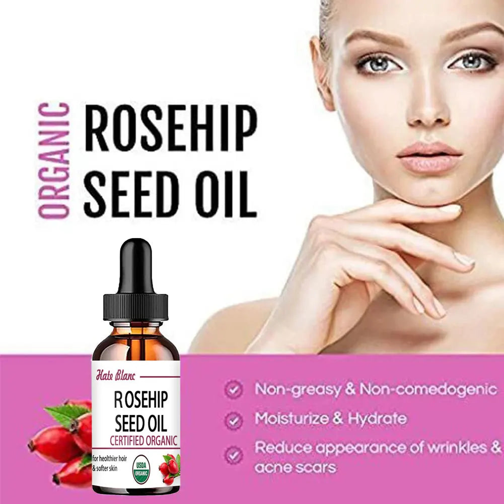 Rosehip Essential Oil – Moisturizing & Brightening